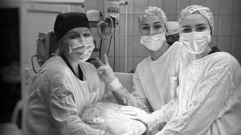 Российские врачи спасли женщину, вытащив из ее желудка шар для похудения